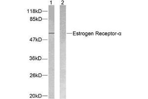Western blot analysis of extracts from MCF7 cells using Estrogen Receptor-α (Ab-118) antibody (E021067). (Estrogen Receptor alpha anticorps)