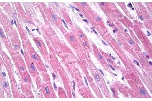 Anti-Brain Natriuretic Peptide 32 antibody IHC staining of human heart. (BNP32 anticorps)