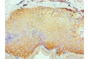 Immunohistochemistry of paraffin-embedded human skin tissue using ABIN7158251 at dilution of 1:100 (SERPINB1 anticorps  (AA 100-379))