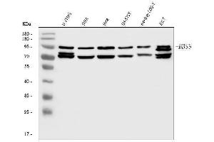 Western blot analysis of BBS9 using anti-BBS9 antibody (ABIN7601518). (BBS9 anticorps  (AA 37-793))
