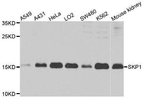 Western blot analysis of extracts of various cell lines, using SKP1 antibody. (SKP1 anticorps  (AA 1-163))