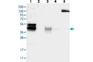 Western blot analysis of Lane 1: RT-4, Lane 2: U-251 MG, Lane 3: Human Plasma, Lane 4: Liver, Lane 5: Tonsil with WDR31 polyclonal antibody  at 1:250-1:500 dilution. (WDR31 anticorps)