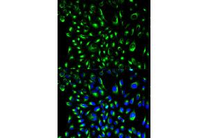 Immunofluorescence analysis of HeLa cells using LCP2 antibody (ABIN6292589). (LCP2 anticorps)