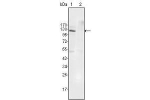 Western Blot showing EphB4 antibody used against Jurkat (1) and HEK293 (2) cell lysate. (EPH Receptor B4 anticorps  (AA 562-612))