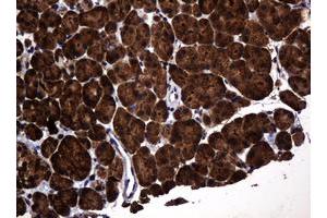 Image no. 2 for anti-Pogo Transposable Element with KRAB Domain (POGK) antibody (ABIN1500329)