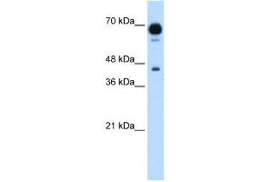 PUS7 antibody used at 1. (PUS7 anticorps)