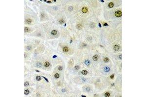Immunohistochemical analysis of Dysbindin 1 staining in rat liver  formalin fixed paraffin embedded tissue section.