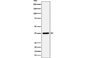 Western blot analysis of Syntaxin 16 expression in HeLa cell lysate.