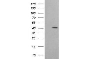 Western Blotting (WB) image for anti-Acetyl-CoA Acyltransferase 2 (ACAA2) antibody (ABIN1495727) (ACAA2 anticorps)