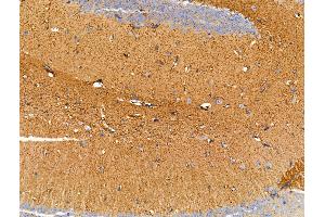 ABIN7094718 and ABIN7098769 at 1/100 staining Mouse brain tissue by IHC-P.