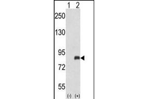 Western blot analysis of ADRBK2 (arrow) using rabbit polyclonal ADRBK2 Antibody (N-term) (ABIN653036 and ABIN2842650). (ADRBK2 anticorps  (N-Term))