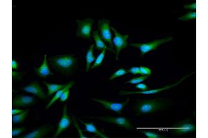 Immunofluorescence of purified MaxPab antibody to ULK4 on HeLa cell. (ULK4 anticorps  (AA 1-580))