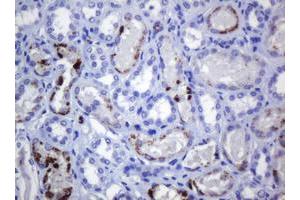 Image no. 1 for anti-Melanoma Antigen Family A, 3 (MAGEA3) antibody (ABIN1499253) (MAGEA3 anticorps)
