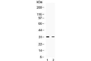 Western blot testing of 1) rat brain and 2) human HeLa lysate with TSG6 antibody at 0.