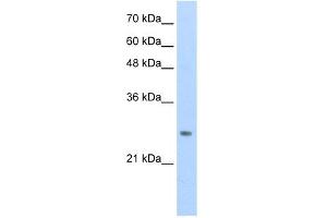 WB Suggested Anti-HOXB7 Antibody Titration:  0. (HOXB7 anticorps  (C-Term))