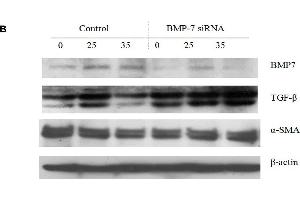 BMP-7 knock down recovered α-SMA and TGF-β expression.