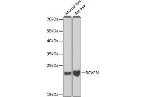 Western blot analysis of extracts of various cell lines, using RCVRN antibody. (Recoverin anticorps)