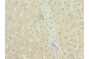 Immunohistochemistry of paraffin-embedded human liver tissue using ABIN7172018 at dilution of 1:100 (TXNRD1 anticorps  (AA 1-497))