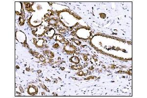 IHC analysis of Prolyl Endopeptidase/PREP using anti-Prolyl Endopeptidase/PREP antibody (ABIN7599118).