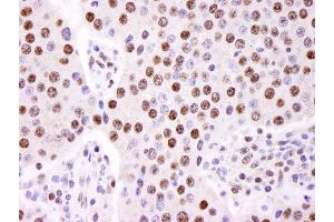 Immunohistochemistry (IHC) image for anti-Heterogeneous Nuclear Ribonucleoprotein K (HNRNPK) (C-Term) antibody (ABIN7448598)