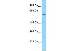 WB Suggested Anti-CCT2 Antibody Titration: 1. (CCT2 anticorps  (Middle Region))