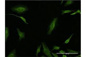 Immunofluorescence of monoclonal antibody to PCNA on HeLa cell.