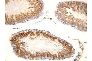 FGF8 Polyclonal Antibody (FGF8 anticorps  (C-Term))