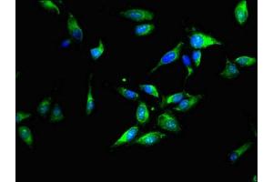 Immunofluorescent analysis of Hela cells using ABIN7142105 at dilution of 1:100 and Alexa Fluor 488-congugated AffiniPure Goat Anti-Rabbit IgG(H+L)