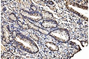 IHC analysis of Caspase-7/CASP7 using anti-Caspase-7/CASP7 antibody (ABIN7600823). (Caspase 7 anticorps  (AA 24-303))