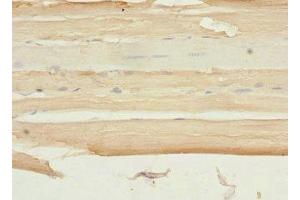 anti-Phosphorylase Kinase, beta (PHKB) (AA 854-1093), (Regulatory Subunit beta) antibody