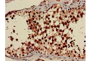 Immunohistochemistry of paraffin-embedded human testis tissue using ABIN7142682 at dilution of 1:100 (PRKAG1 anticorps  (AA 1-331))