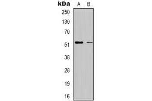 Western blot analysis of RSAD1 expression in HepG2 (A), Hela (B) whole cell lysates. (RSAD1 anticorps)