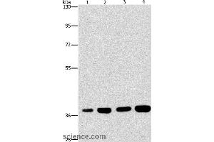 Western blot analysis of 293T and 231 cell, U937 and Raji cell, using SERPINA9 Polyclonal Antibody at dilution of 1:337. (SERPINA9 anticorps)