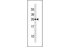 DENR Antibody (Center) (ABIN1881257 and ABIN2843223) western blot analysis in 293 cell line lysates (35 μg/lane). (Density Regulated Protein anticorps  (AA 47-76))