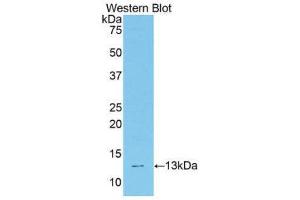 Western Blotting (WB) image for anti-Transcription Factor 20 (TCF20) (AA 1871-1965) antibody (ABIN1860689) (TCF20 anticorps  (AA 1871-1965))