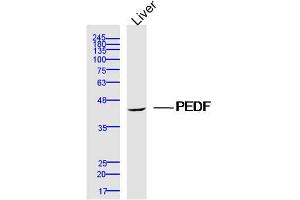 Mouse Liver lysates probed with PEDF Polyclonal Antibody, Unconjugated  at 1:300 dilution and 4˚C overnight incubation. (PEDF anticorps  (AA 101-200))