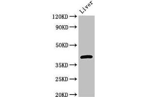 Western Blot Positive WB detected in: Mouse liver tissue All lanes: GNAT1 antibody at 3 μg/mL Secondary Goat polyclonal to rabbit IgG at 1/50000 dilution Predicted band size: 41 kDa Observed band size: 41 kDa