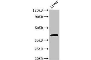 Western Blot Positive WB detected in: Mouse liver tissue All lanes: GNAT1 antibody at 3 μg/mL Secondary Goat polyclonal to rabbit IgG at 1/50000 dilution Predicted band size: 41 kDa Observed band size: 41 kDa (GNAT1 anticorps  (AA 92-170))