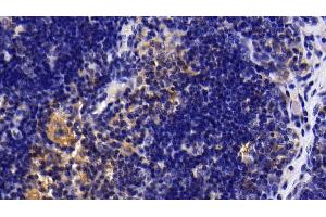 Detection of IL1R1 in Rat Thymus Tissue using Polyclonal Antibody to Interleukin 1 Receptor Type I (IL1R1)