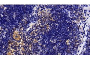 Detection of IL1R1 in Rat Thymus Tissue using Polyclonal Antibody to Interleukin 1 Receptor Type I (IL1R1) (IL1R1 anticorps  (AA 226-352))