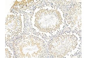 ABIN7094849 and ABIN7098900 at 1/100 staining Rat testis tissue by IHC-P. (ZNF281 anticorps  (Internal Region))
