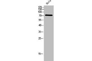Western Blot analysis of Hela cells using ACSVL6 Polyclonal Antibody