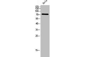 Western Blot analysis of Hela cells using ACSVL6 Polyclonal Antibody (SLC27A5 anticorps  (Internal Region))