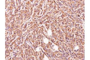 IHC-P Image Immunohistochemical analysis of paraffin-embedded SAS xenograft, using GLYATL1, antibody at 1:500 dilution.