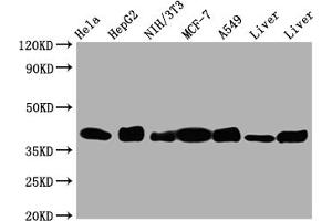 Western Blot Positive WB detected in: Hela whole cell lysate, HepG2 whole cell lysate, NIH/3T3 whole cell lysate, A549 whole cell lysate, Mouse Liver whole cell lysate, Rat Liver whole cell lysate All lanes: Aldolase antibody at 1:1000 Secondary Goat polyclonal to rabbit IgG at 1/50000 dilution Predicted band size: 40, 46 kDa Observed band size: 40 kDa (Recombinant ALDOA anticorps)