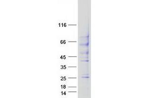 Validation with Western Blot