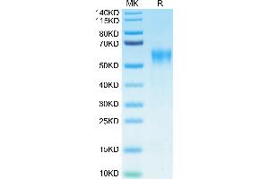 Biotinylated Human IL-15RA on Tris-Bis PAGE under reduced condition.