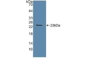 Detection of Recombinant Tie2, Human using Polyclonal Antibody to TEK Tyrosine Kinase, Endothelial (Tie2) (TEK anticorps  (AA 286-465))