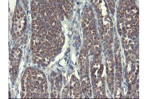 anti-Diphthamide Biosynthesis Protein 2 (DPH2) antibody