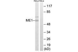 Western blot analysis of extracts from HeLa cells, using ME1 Antibody. (ME1 anticorps  (AA 468-517))